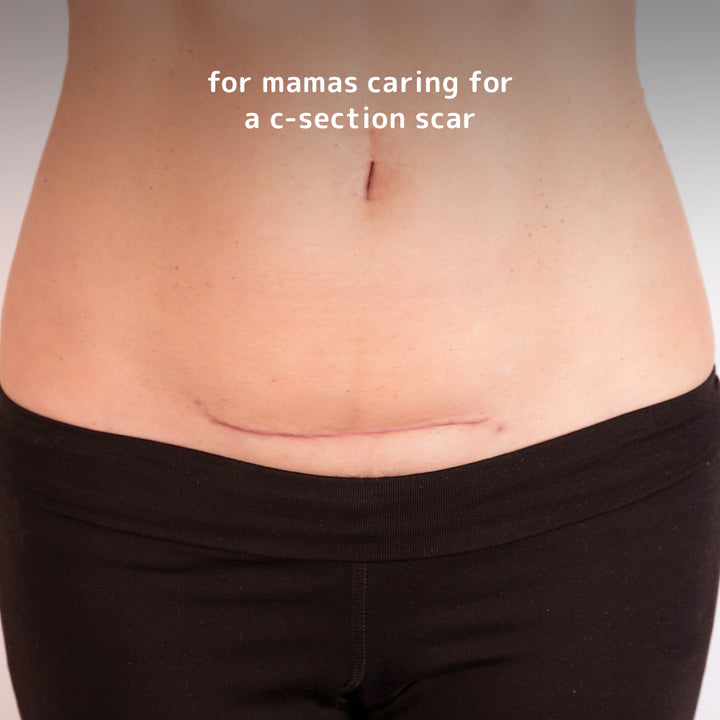 c-section recovery silicone scar patches